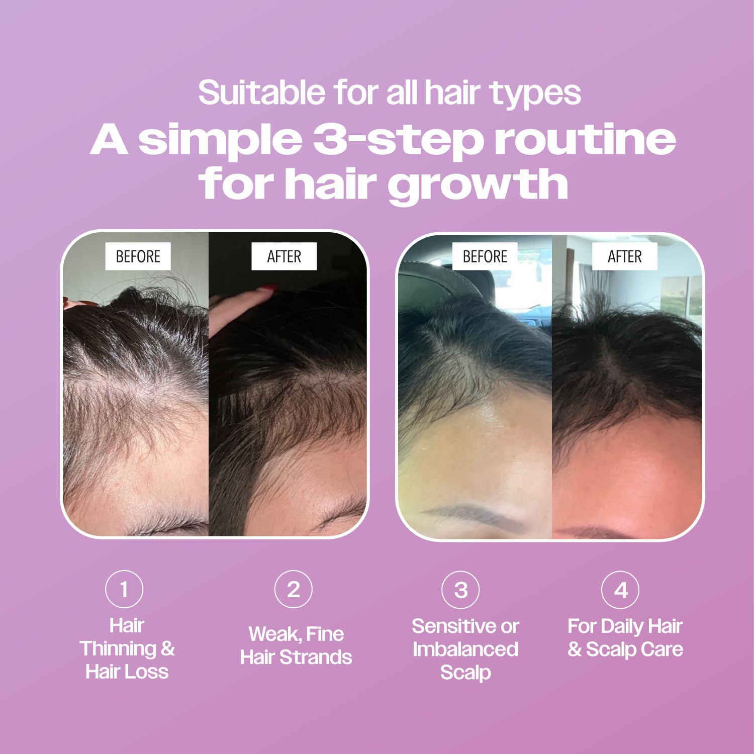 3 Hair-venly Kings of Hair Growth - Your Complete Hair Care Solution