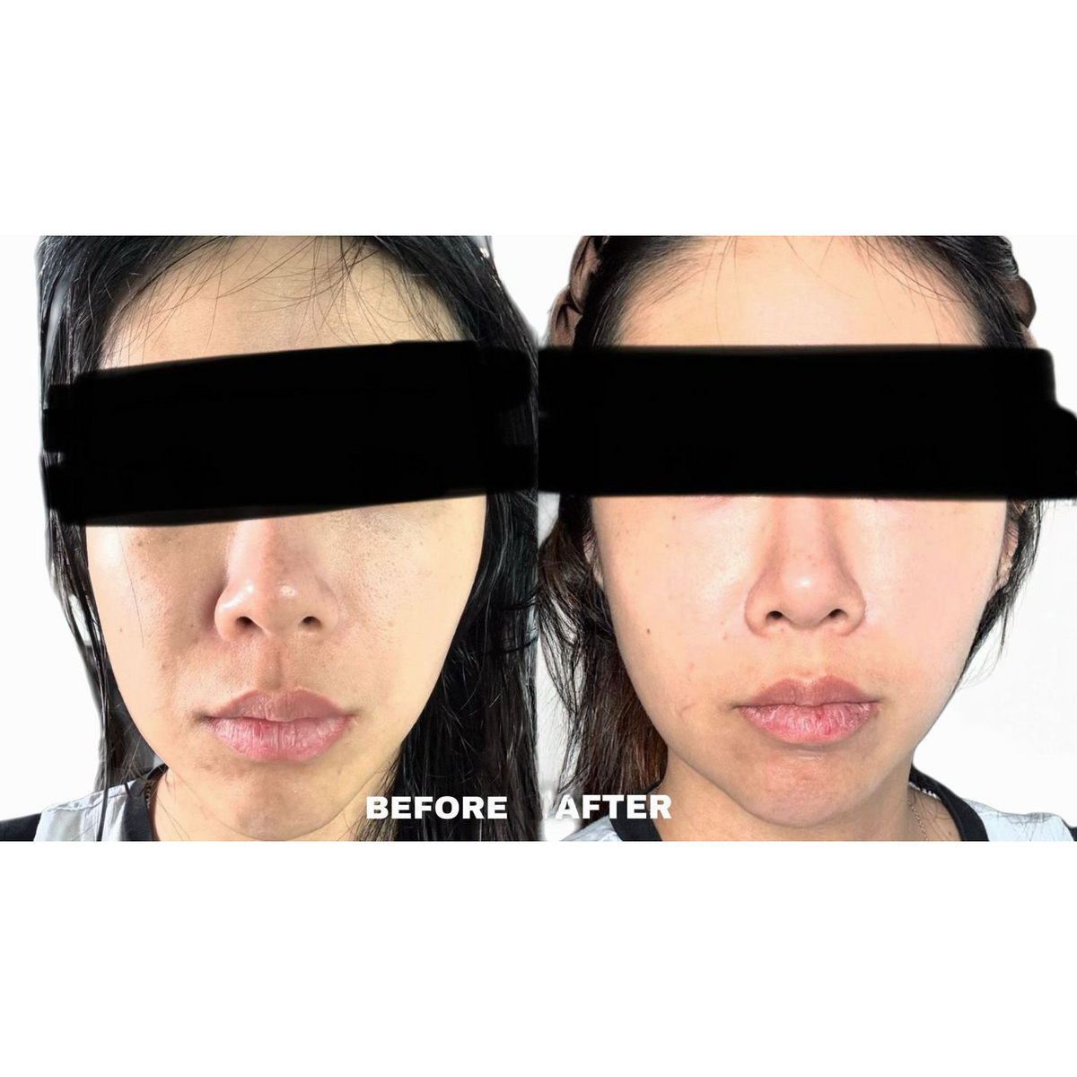 Matrix Rejuvenation